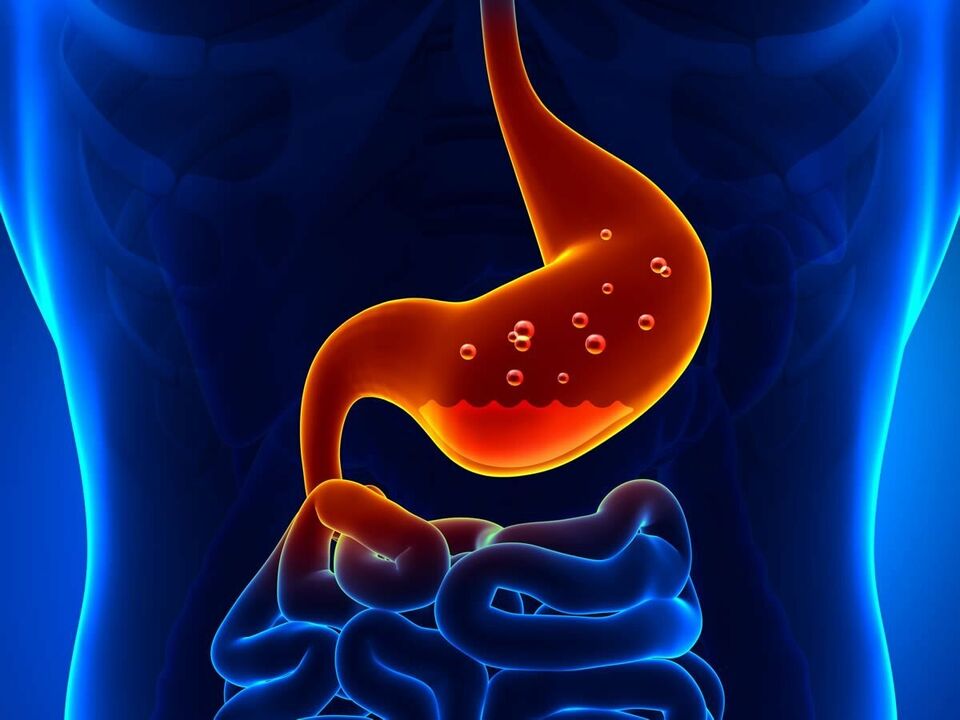 La gastrite est une maladie inflammatoire de l'estomac qui nécessite un régime